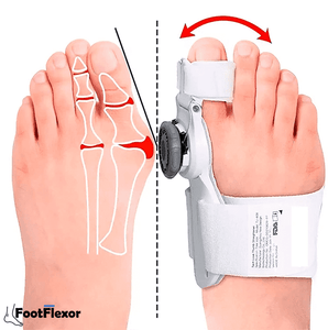 CORRECTOR DE JUANETES DE PIE GORDO CON FÉRULA ACTUALIZADO 🦶🦵 FootFlexor