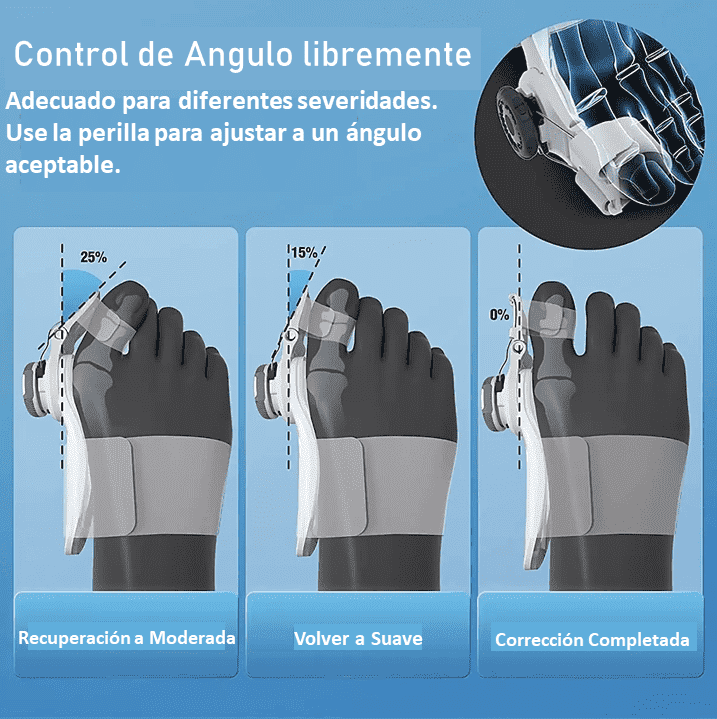 CORRECTOR DE JUANETES DE PIE GORDO CON FÉRULA ACTUALIZADO 🦶🦵 FootFlexor