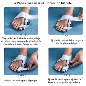 CORRECTOR DE JUANETES DE PIE GORDO CON FÉRULA ACTUALIZADO 🦶🦵 FootFlexor