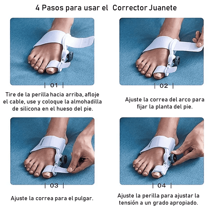 CORRECTOR DE JUANETES DE PIE GORDO CON FÉRULA ACTUALIZADO 🦶🦵 FootFlexor